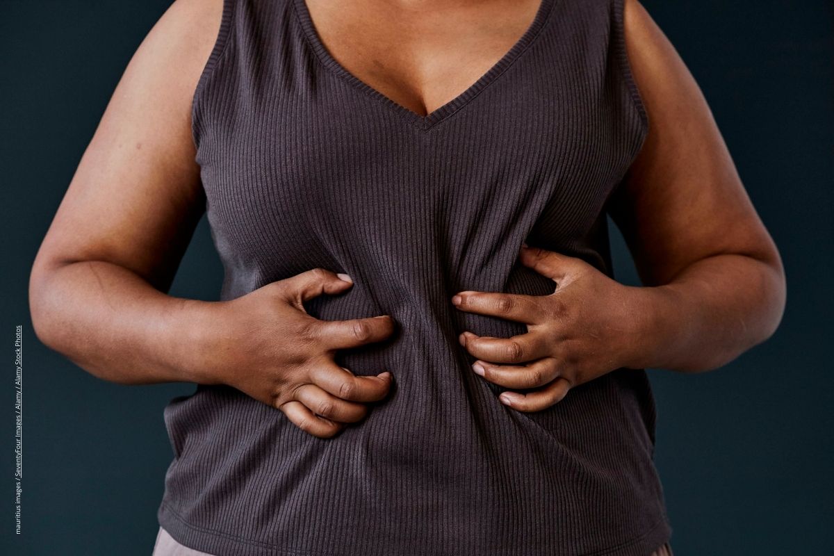 Adipositas: Risiko für Hautkrankheiten