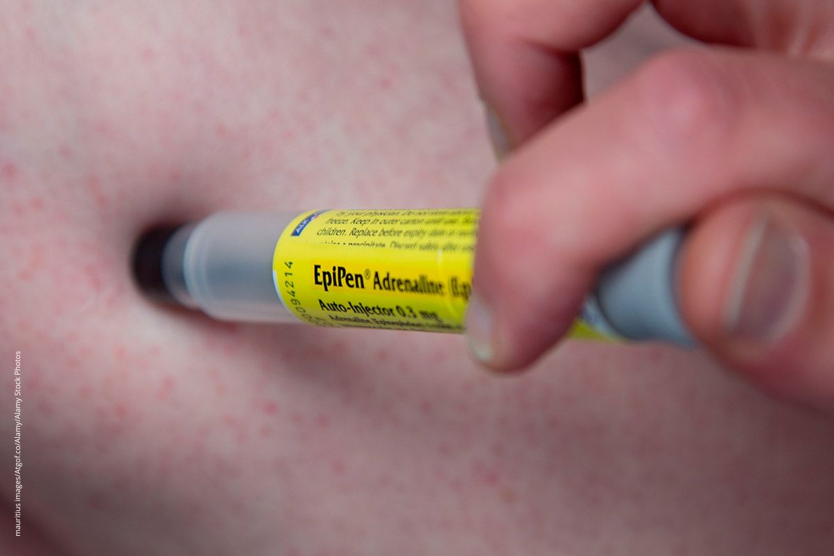 7 Lebensretter bei allergischem Schock