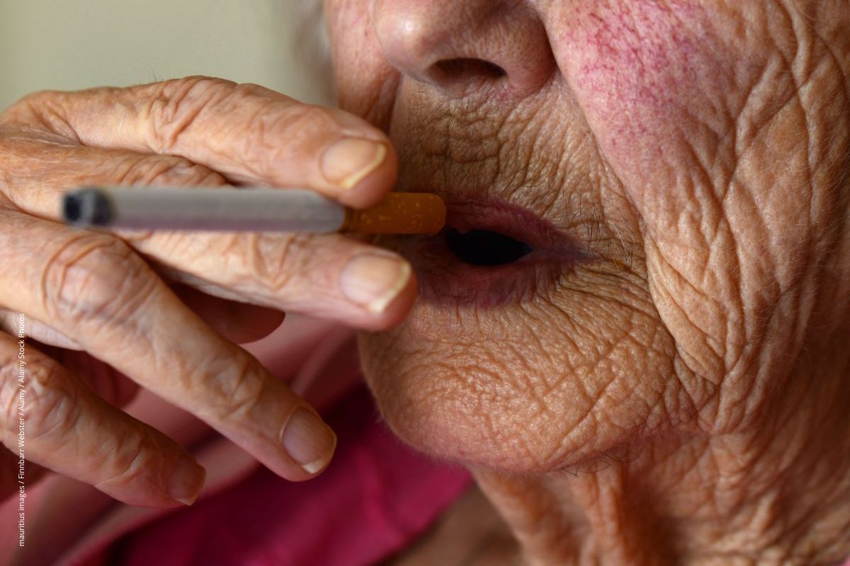  Rauchen ist der häufigste Grund für eine Polyglobulie.