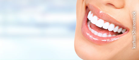 Parodontitis vorbeugen