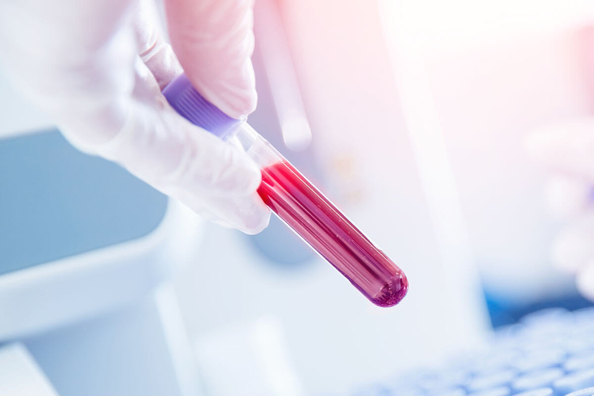 Alzheimer im Blut erkennen?, © Parilov/Shutterstock.com