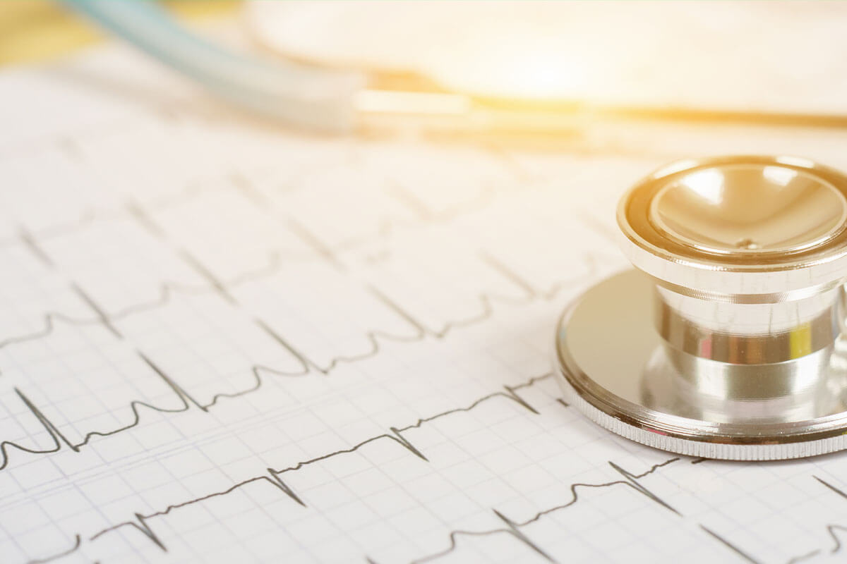 Im EKG lassen sich Unregelmäßigkeiten des Herzschlags gut nachvollziehen. Im EKG lassen sich Unregelmäßigkeiten des Herzschlags gut nachvollziehen.