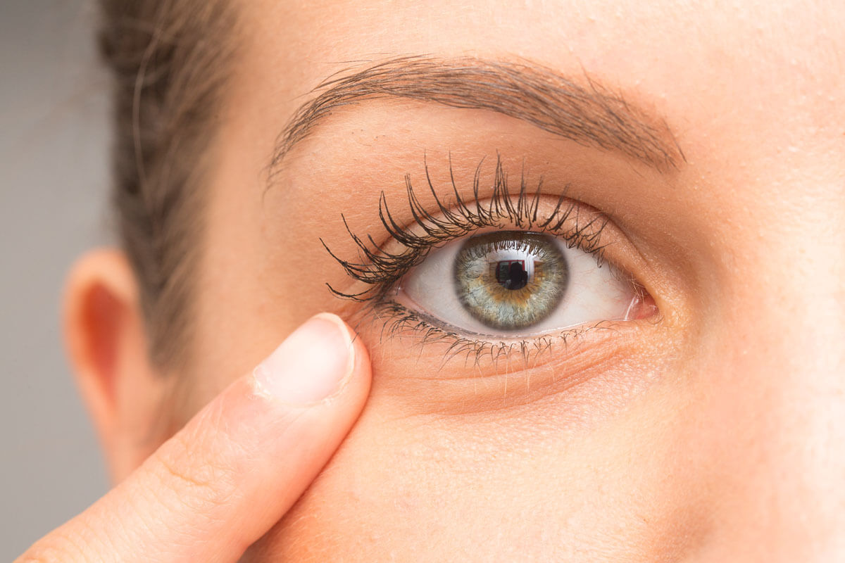 Augenringe und ihre Behandlung, © sruilk/Shutterstock.com