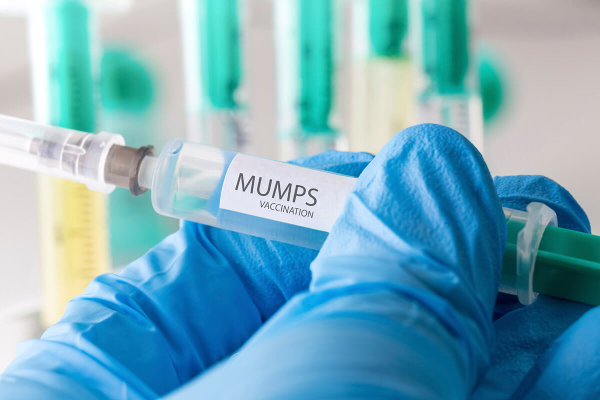 Zuverlässigen Schutz gegen Mumps bietet eine Kombi-Impfung gegen Masern, Mumps und Röteln. Zuverlässigen Schutz gegen Mumps bietet eine Kombi-Impfung gegen Masern, Mumps und Röteln.