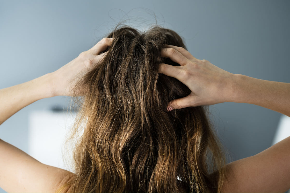 Was tun gegen Kopfschuppen?, © Andrey_Popov/shutterstock.com
