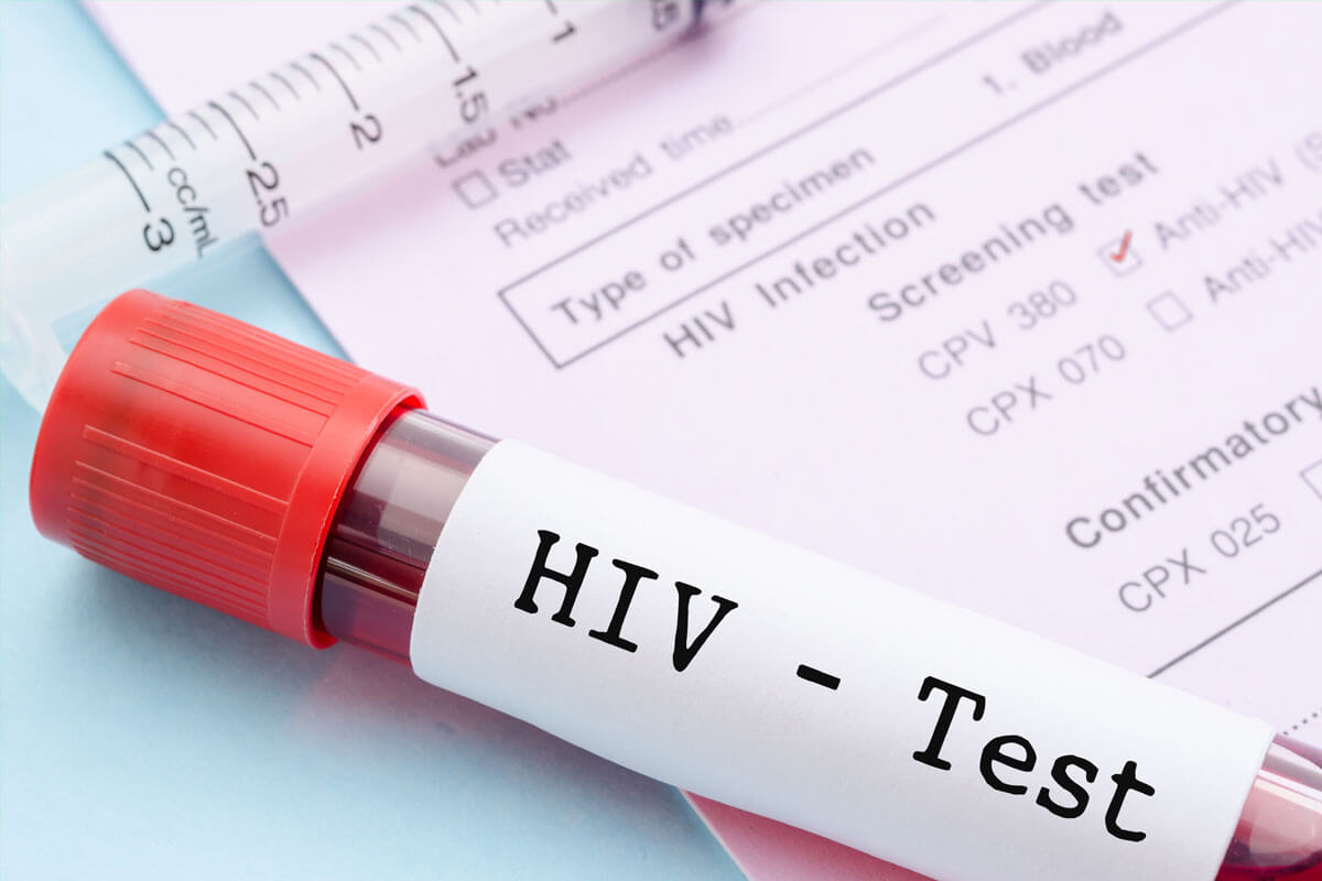 Quelle: Room´s studio/Shutterstock.com Wann zum HIV-Test?