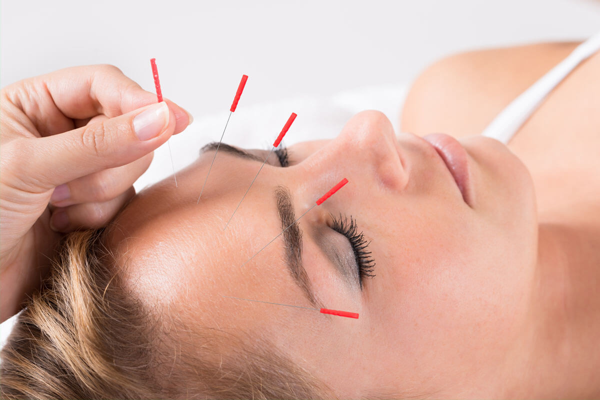 Die Akupunktur ist nur ein kleiner Teil der TCM. Darüber hinaus spielen vor allem Ernährung und Bewegung eine große Rolle im Therapiekonzept. Die Akupunktur ist nur ein kleiner Teil der TCM. Darüber hinaus spielen vor allem Ernährung und Bewegung eine große Rolle im Therapiekonzept.